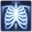 x-ray on Facebook